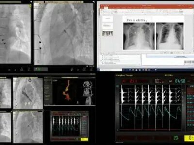 Major-Hospital-in-Thailand-using-TriCaster[1]